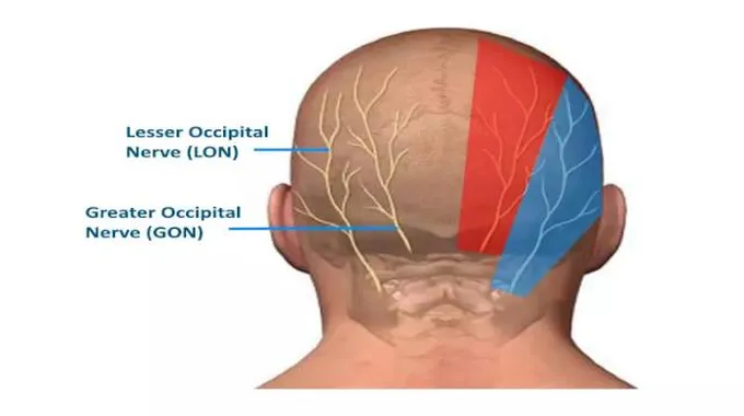 التهاب أعصاب الرأس: أسبابه وأعراضه وعلاجه