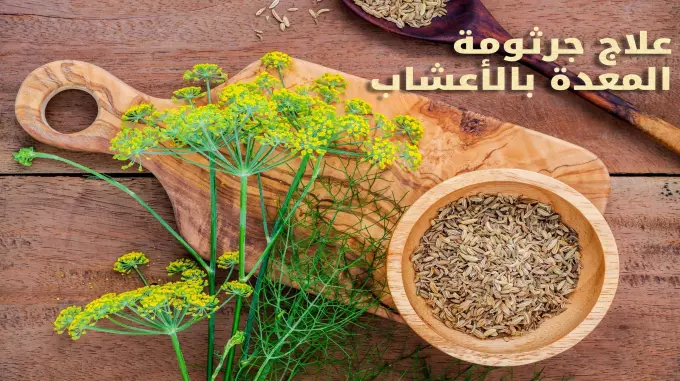 علاج جرثومة المعدة بالأعشاب